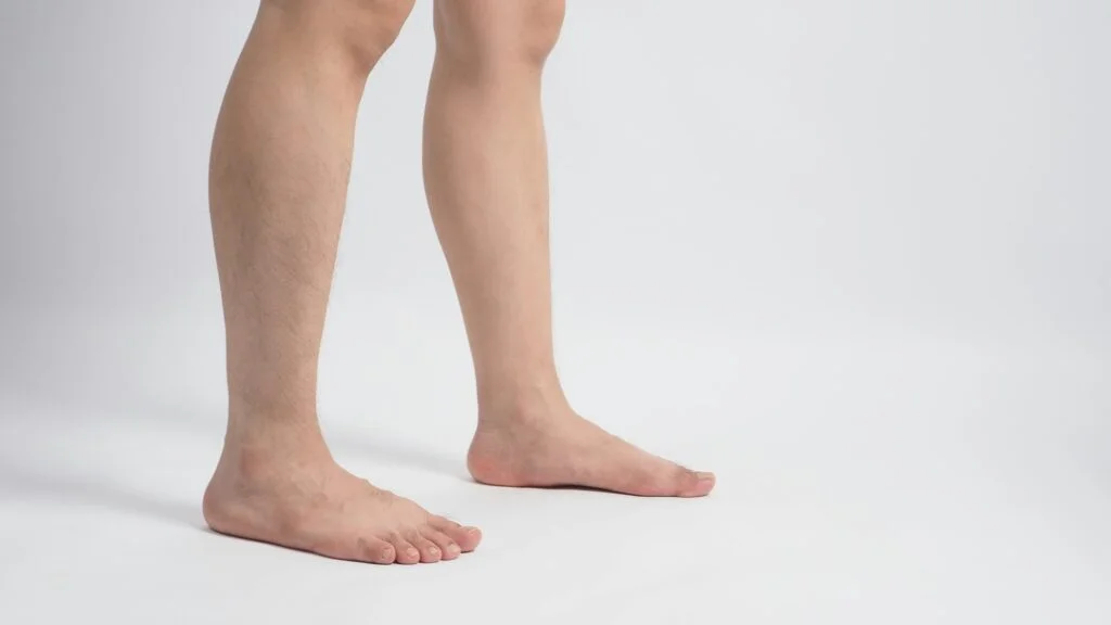 Person with flat feet standing.
